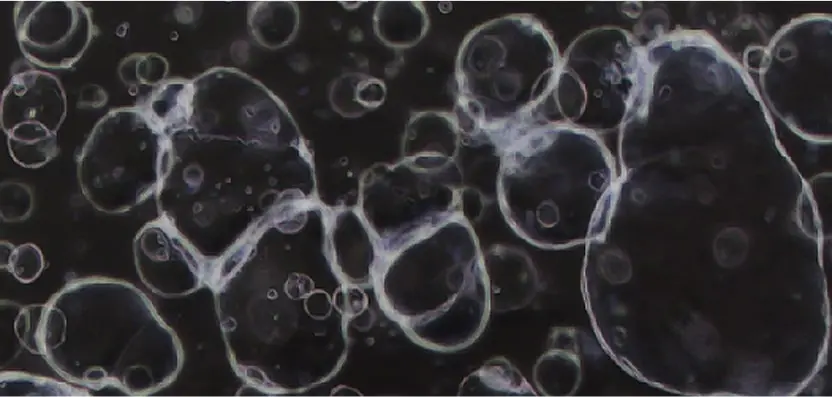 Hepatocellular Carcinoma